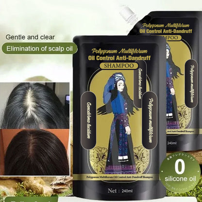 ✨Last Day Promotio🎁Hot Sale Ginger Plant Extract Anti-Hair Loss Hair Shampoo