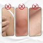 Whitening Body Lotion Remove Chicken Skin