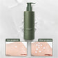 Whitening Body Lotion Remove Chicken Skin